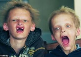 Is vampire disease real?
