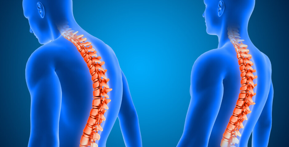 What is the best treatment for sciatica pain?