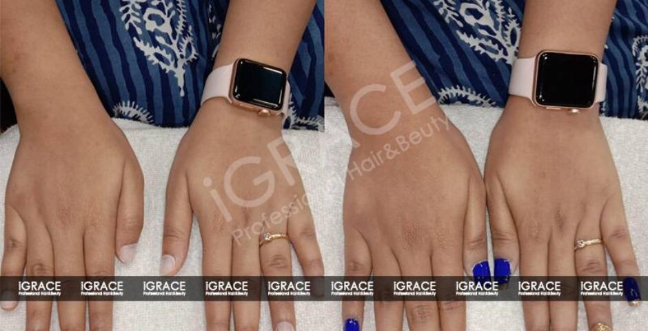 Best Nail Design Services In Visakhapatnam